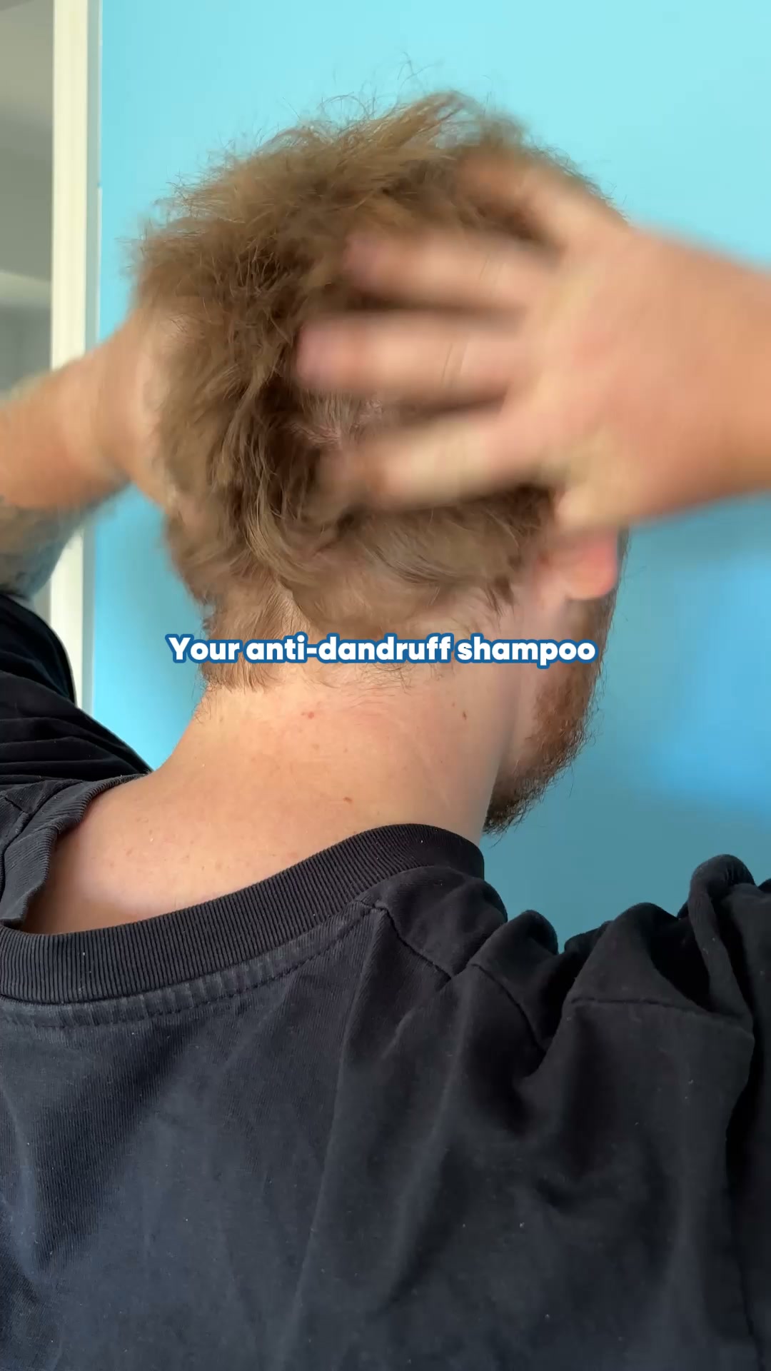 Sensitive Scalp? Find Relief Today!