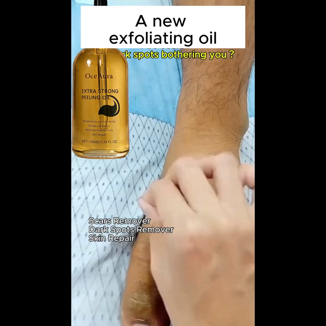 Are you tired of dealing with rough, dry and cracked skin on your hands?