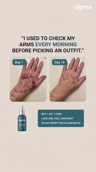 You shouldn't have to explain your arms