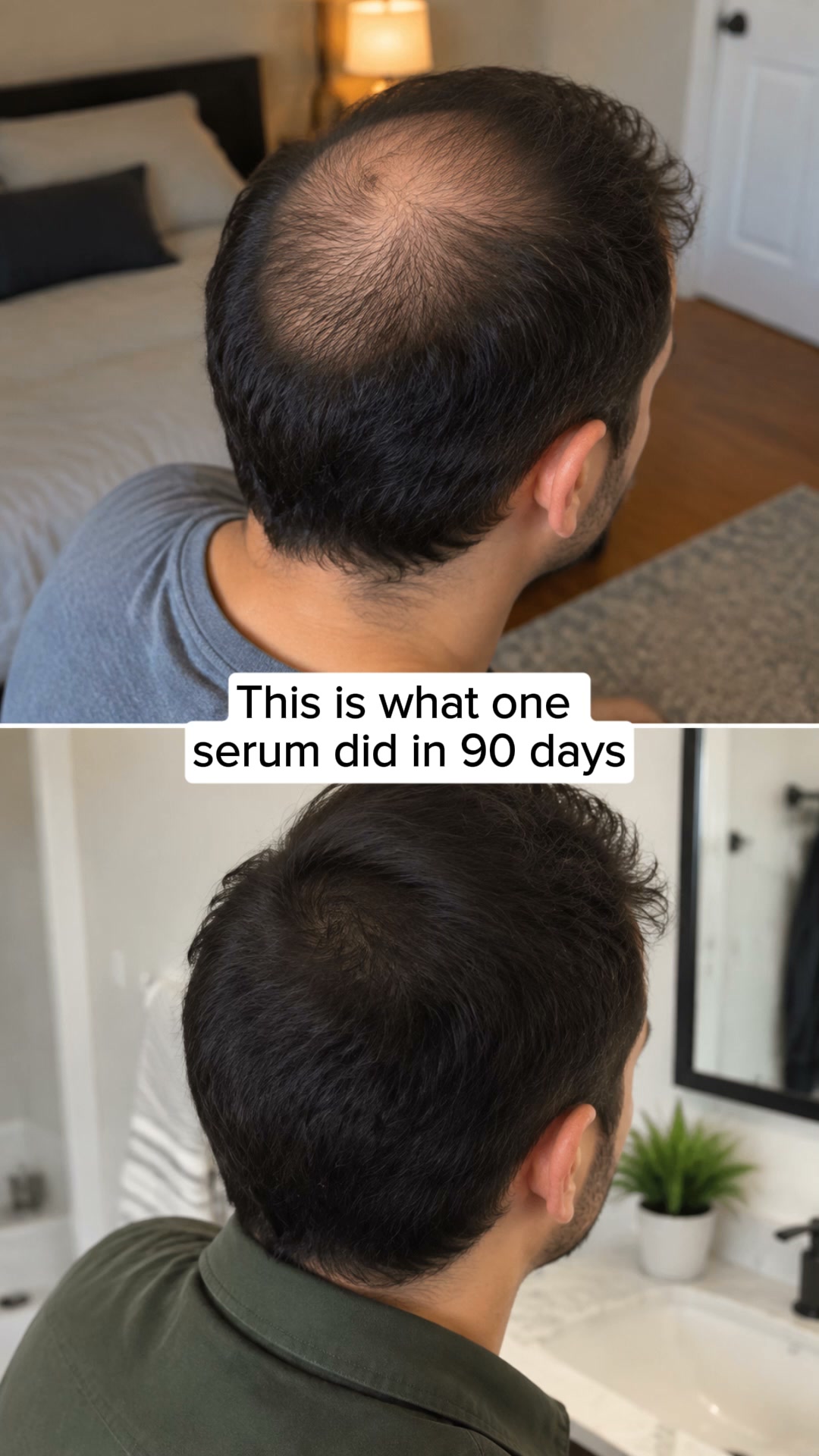 Korean Scalp Science, No Rx Needed