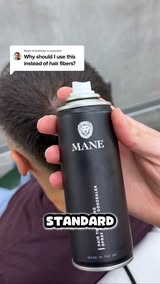 Seeing More Scalp Lately?