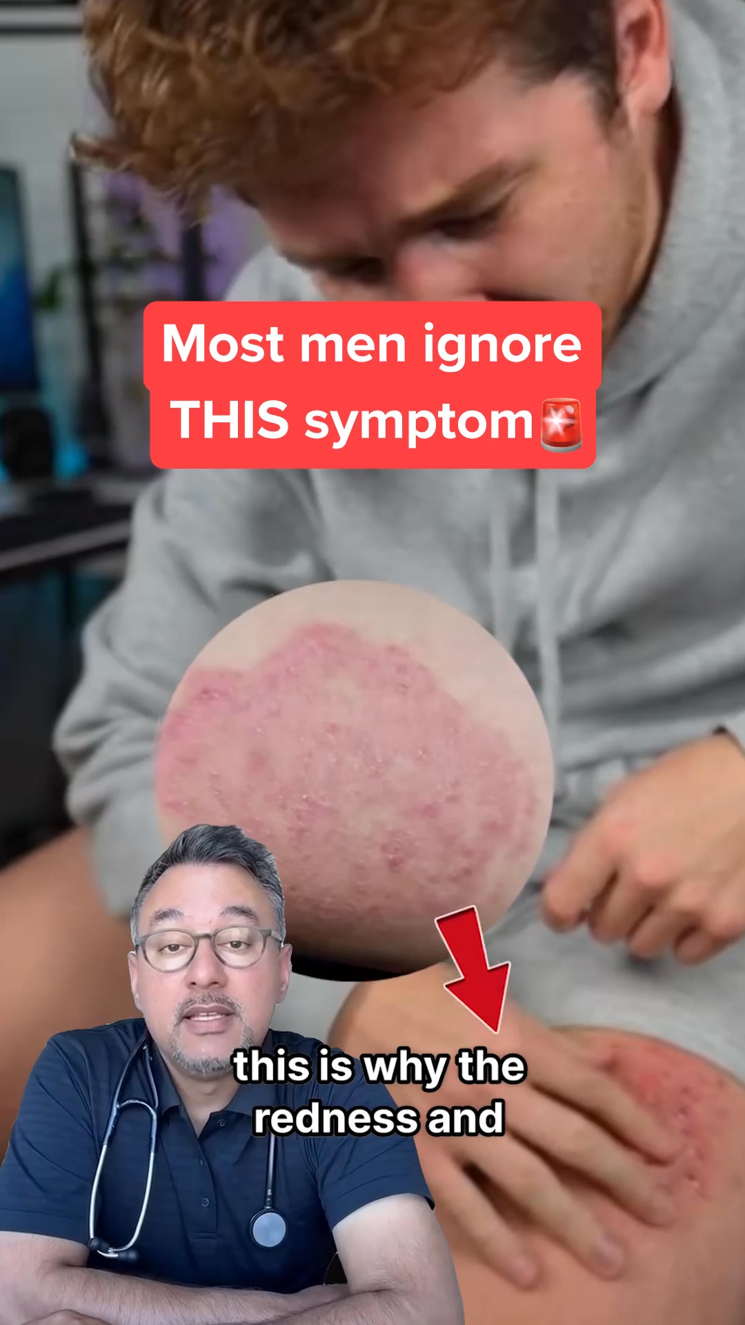 Why Your Jock Itch Keeps Coming Back