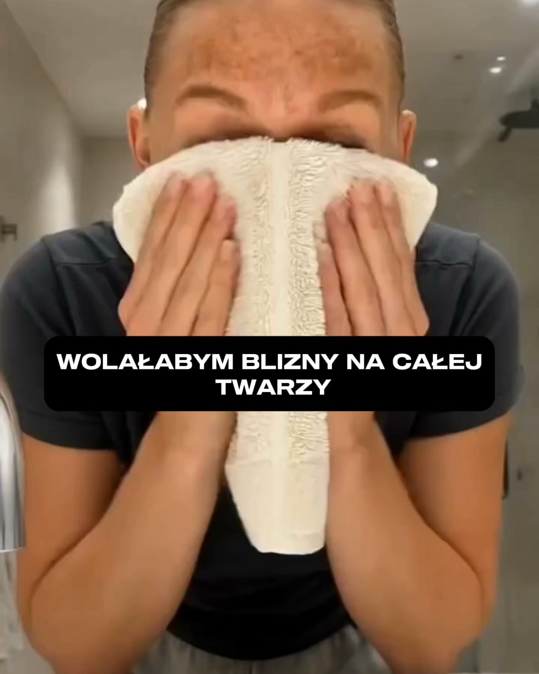 𝗞𝗼𝗻𝗶𝗲𝗰 𝘇 𝗰𝗶𝗲𝗺𝗻𝘆𝗺𝗶 𝗽𝗹𝗮𝗺𝗮𝗺𝗶 𝗻𝗮 𝘁𝘄𝗮𝗿𝘇𝘆