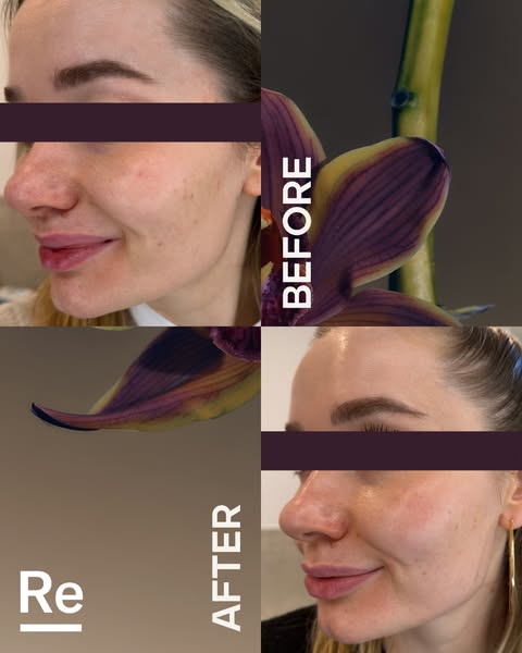The science of balanced skin