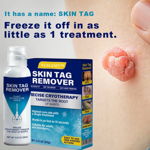 Fivfivgo® TagRecede Cryo Treatment Spray