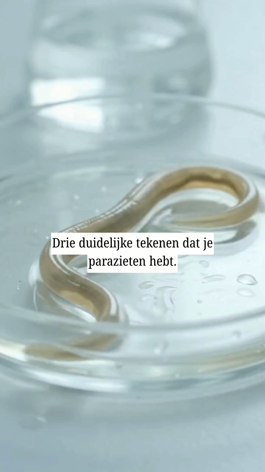 Verwijder wat al jaren in je darmen zit