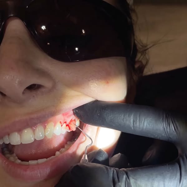 She flossed every day... her teeth came out anyway