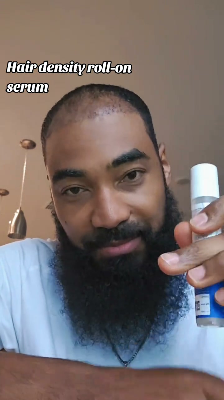 Hair thinning at the crown or temples?