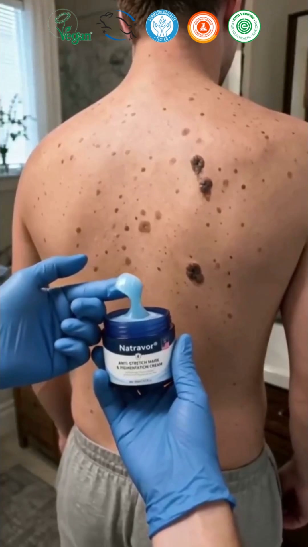 Wir präsentieren die „7-Day Skin Tag & Spot Eraser Cream“