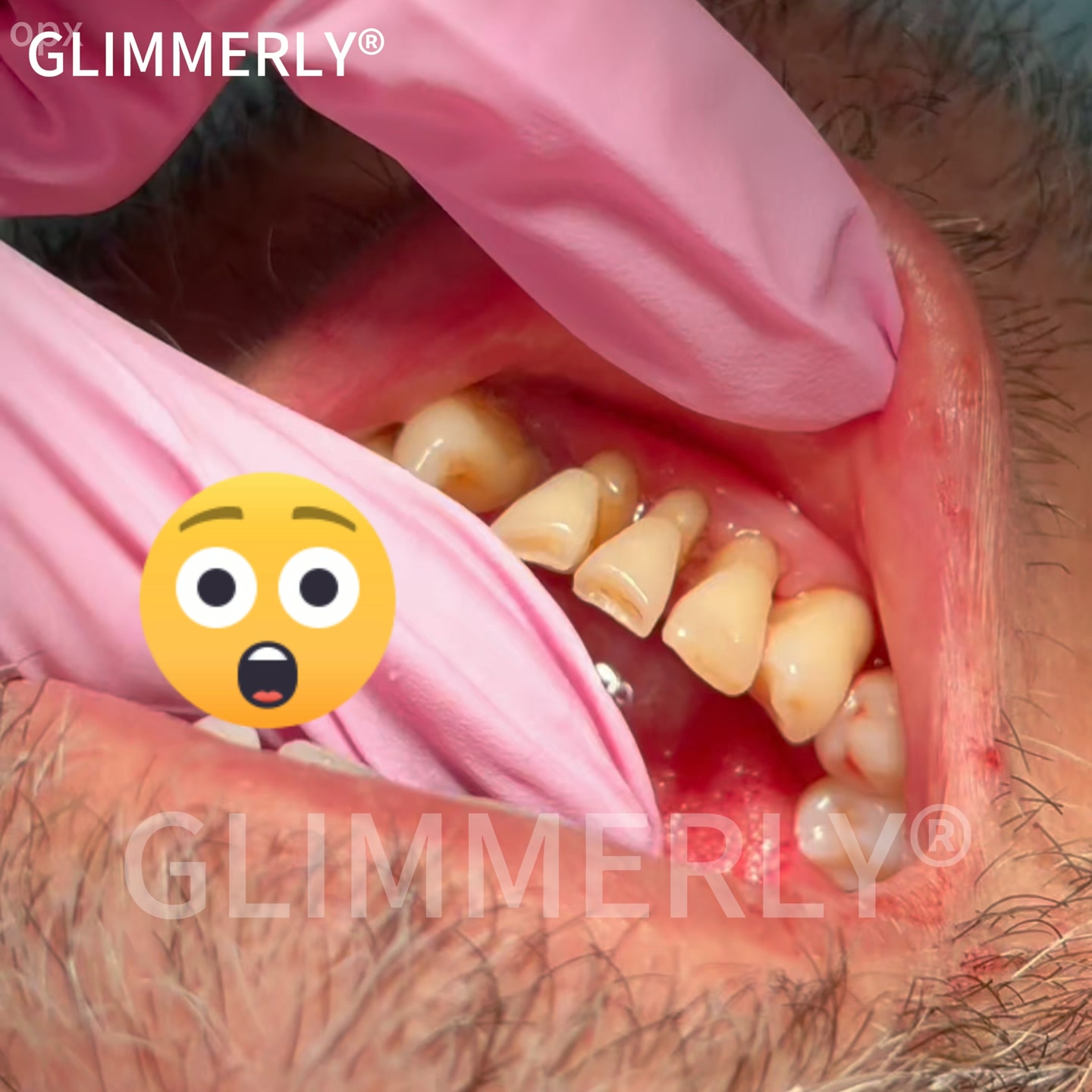 Fabricado y enviado desde España | Certificado CE | Certificado como eficaz según la Sociedad Española de Periodoncia (SEPA)