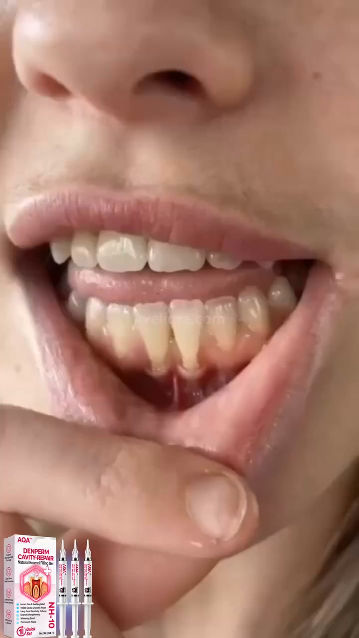Vous avez commencé à manger différemment à cause de vos dents ?