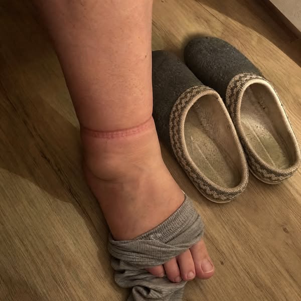 Schwere Beine trotz Kompression? Das hat mir geholfen