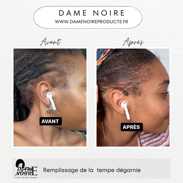 Votre routine commence à la racine