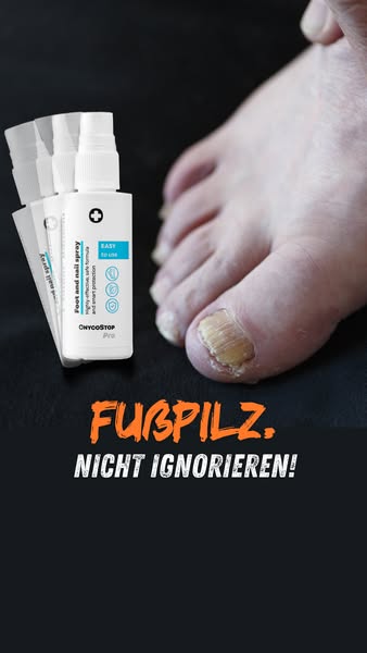 Fußpilz. Nicht ignorieren!