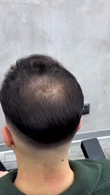 Spray-On Hair Thickener