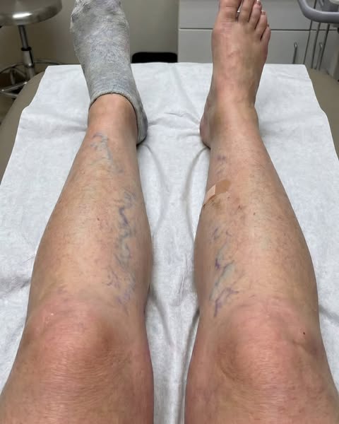 Your Vein Scan Doesn't Decide How You Feel