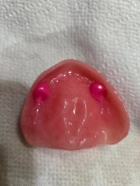Read this if you wear dentures and use cream.