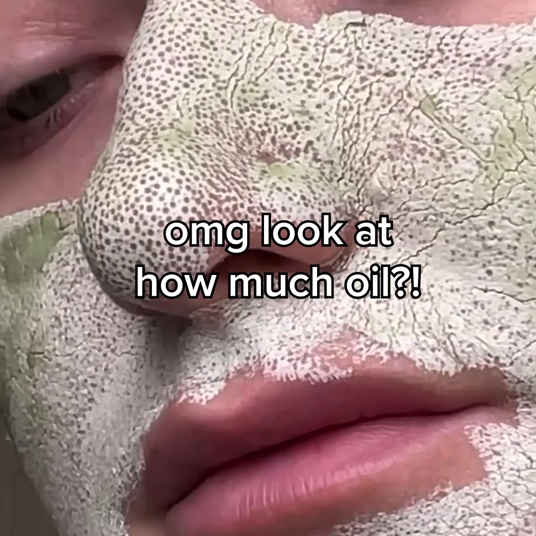 TikTok Viral Mask For Oily, Acne-Prone Skin