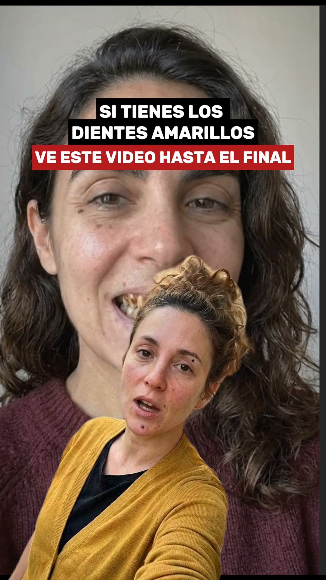 Unidades Limitadas