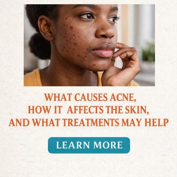 Understanding Acne Treatment and Skin Care