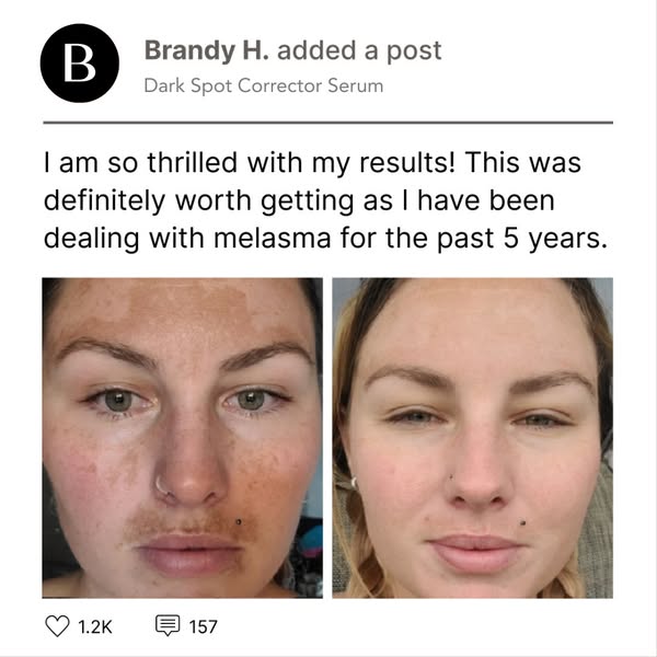 The Dark Spot Myth: The Real Reason Spots Keep Coming Back