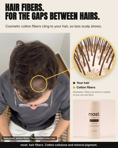 Less scalp under overhead light