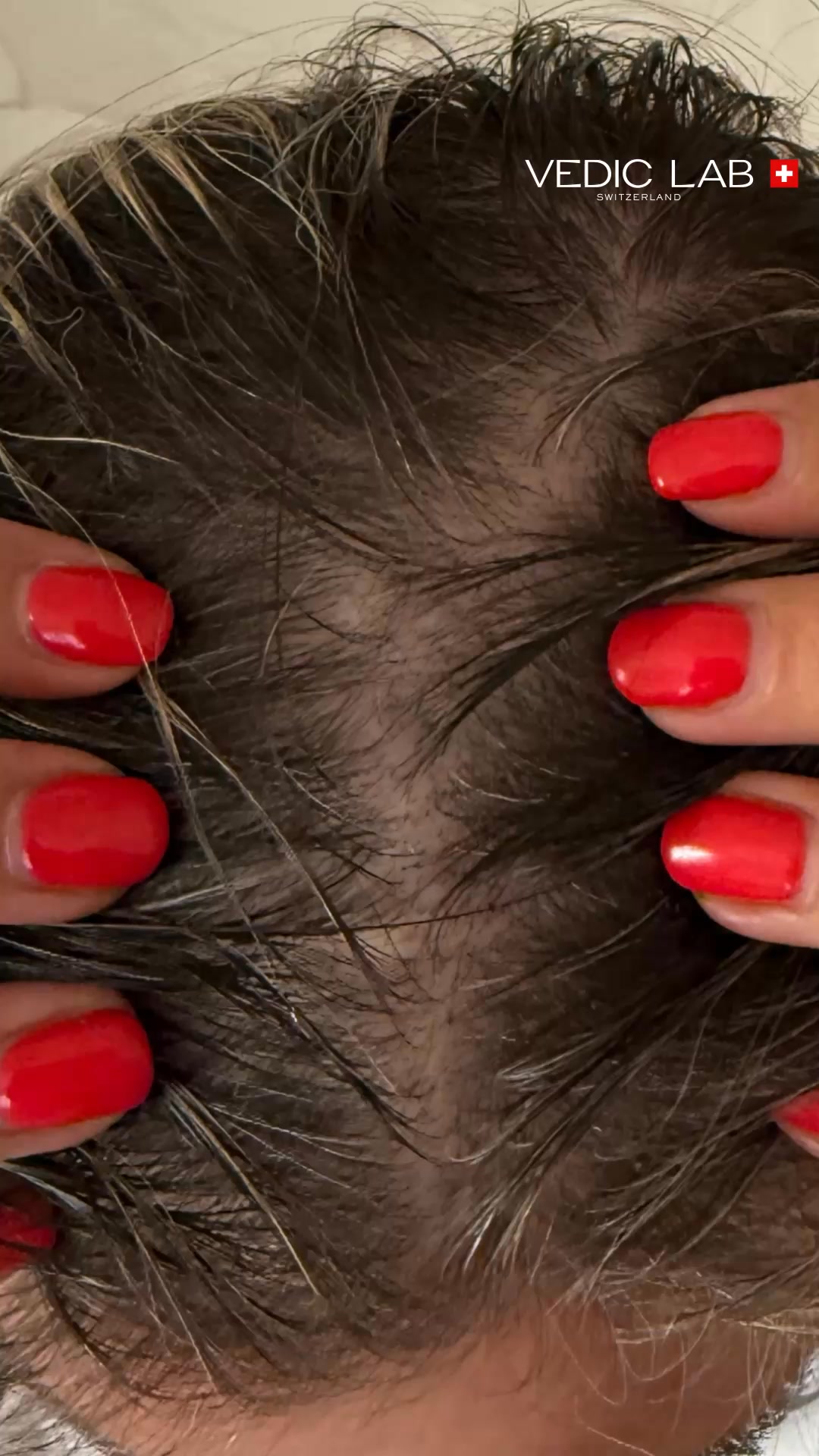 Up to 83% less hair loss