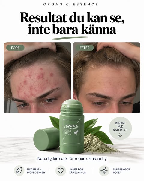 Minska akne naturligt