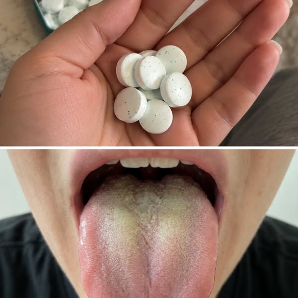 Avoiding Kisses Because of Zepbound Breath? It’s Not Your Hygiene