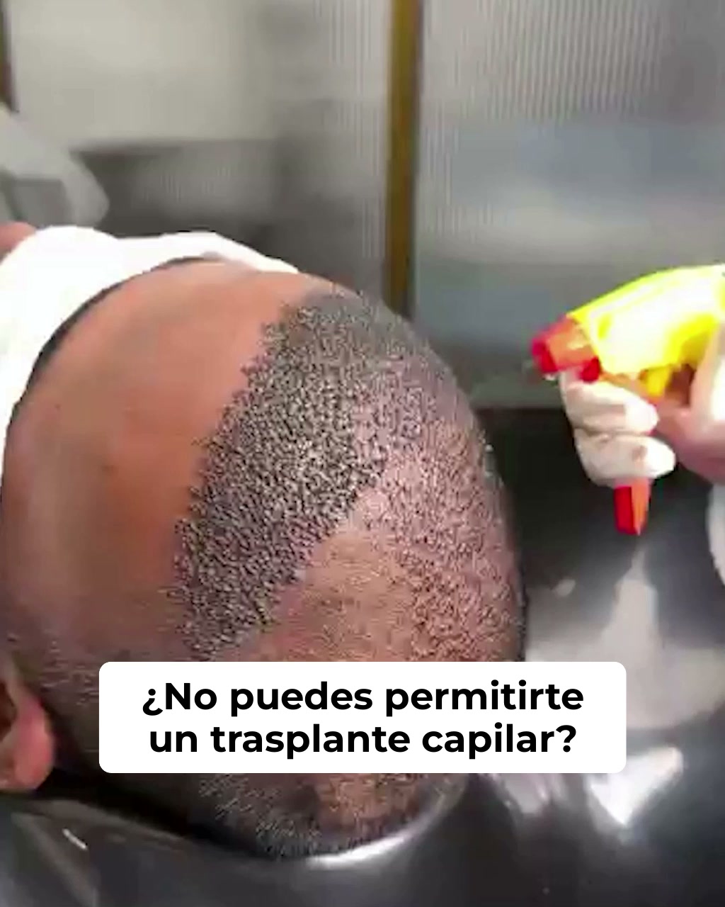 Reactiva tus folículos naturalmente