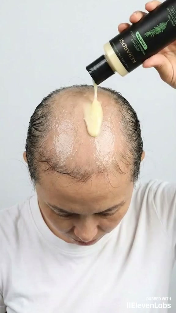 Rosmarino Fa Quello che Nessuno Shampoo Ha Mai Fatto