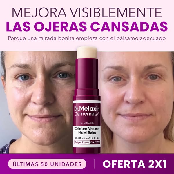 ÚLTIMAS UNIDADES!!