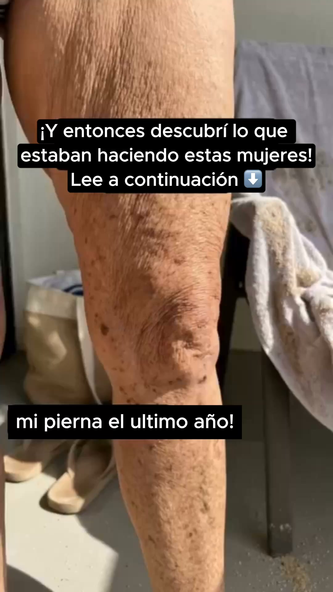Elige el resplandor del verano. Elige Elixir de Curezpro.