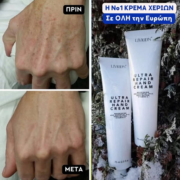 ΛΕΥΚΑΙΝΕΙ - ΕΠΑΝΟΡΘΩΝΕΙ ΔΡΑΣΤΙΚΑ!!