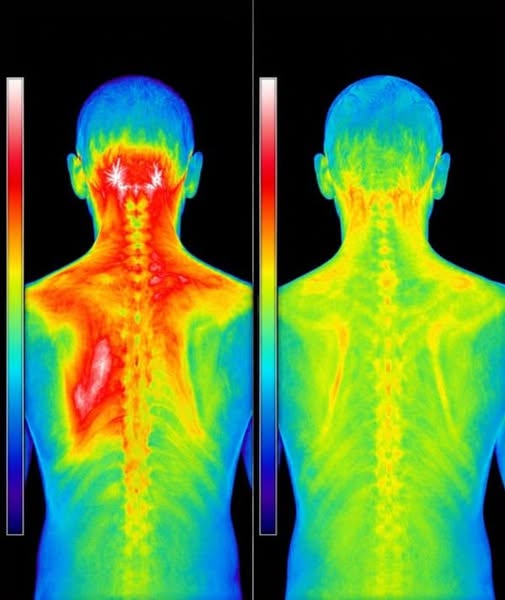 Read this if your neck pain is ruining your life