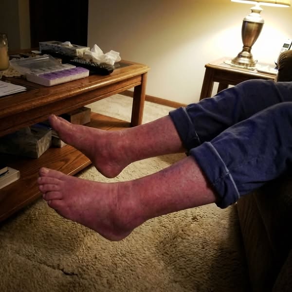 Leggi qui se tieni le gambe sollevate sul divano ogni sera.