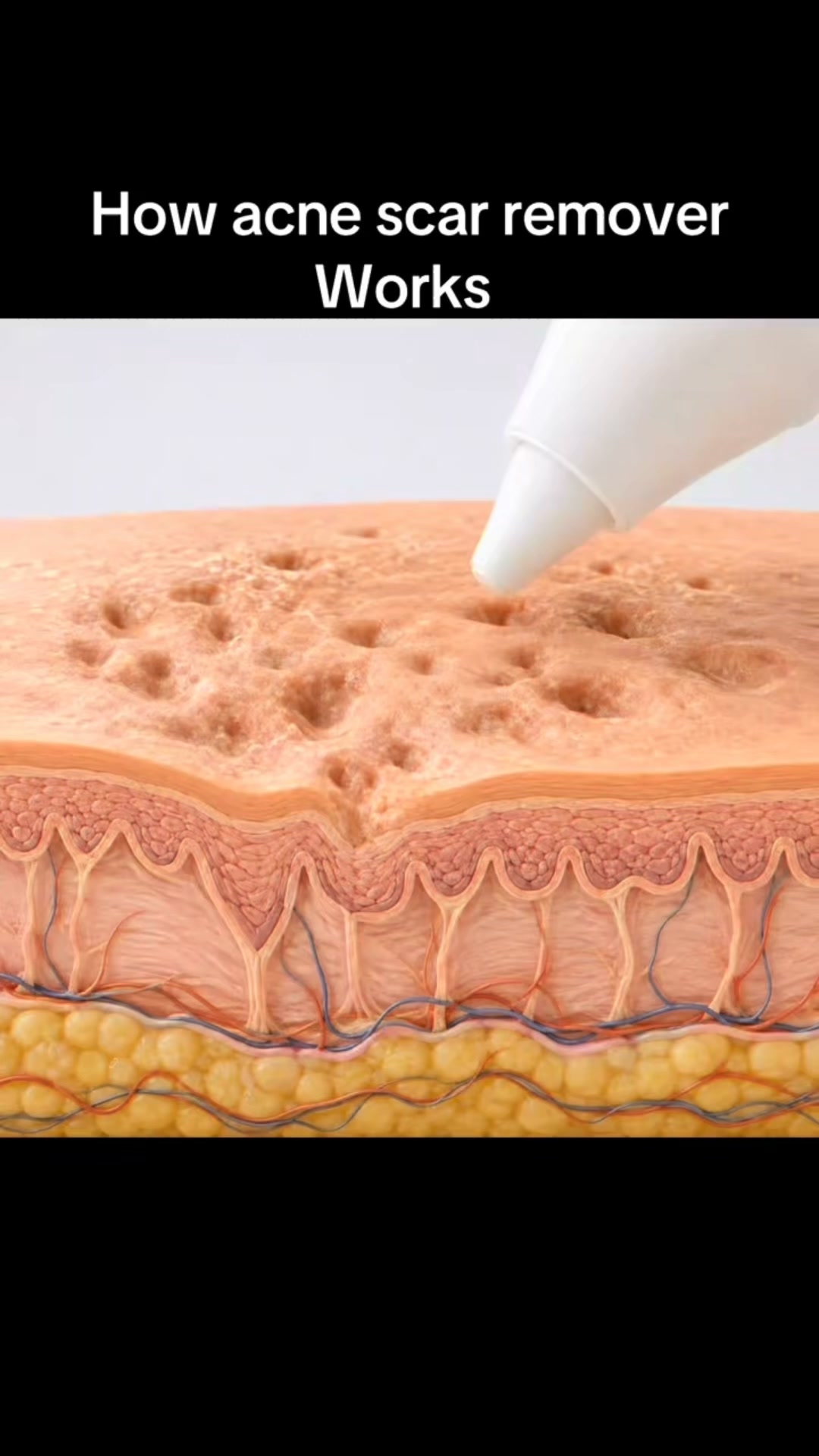 The Korean Answer To Acne’s Aftermath