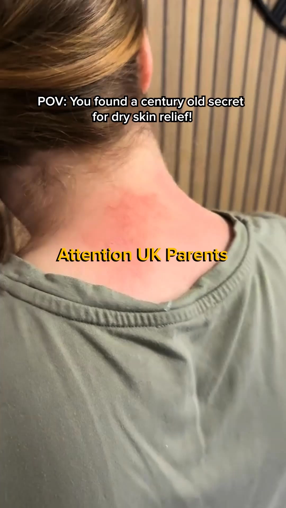 Bee-utiful Skin Starts Here!