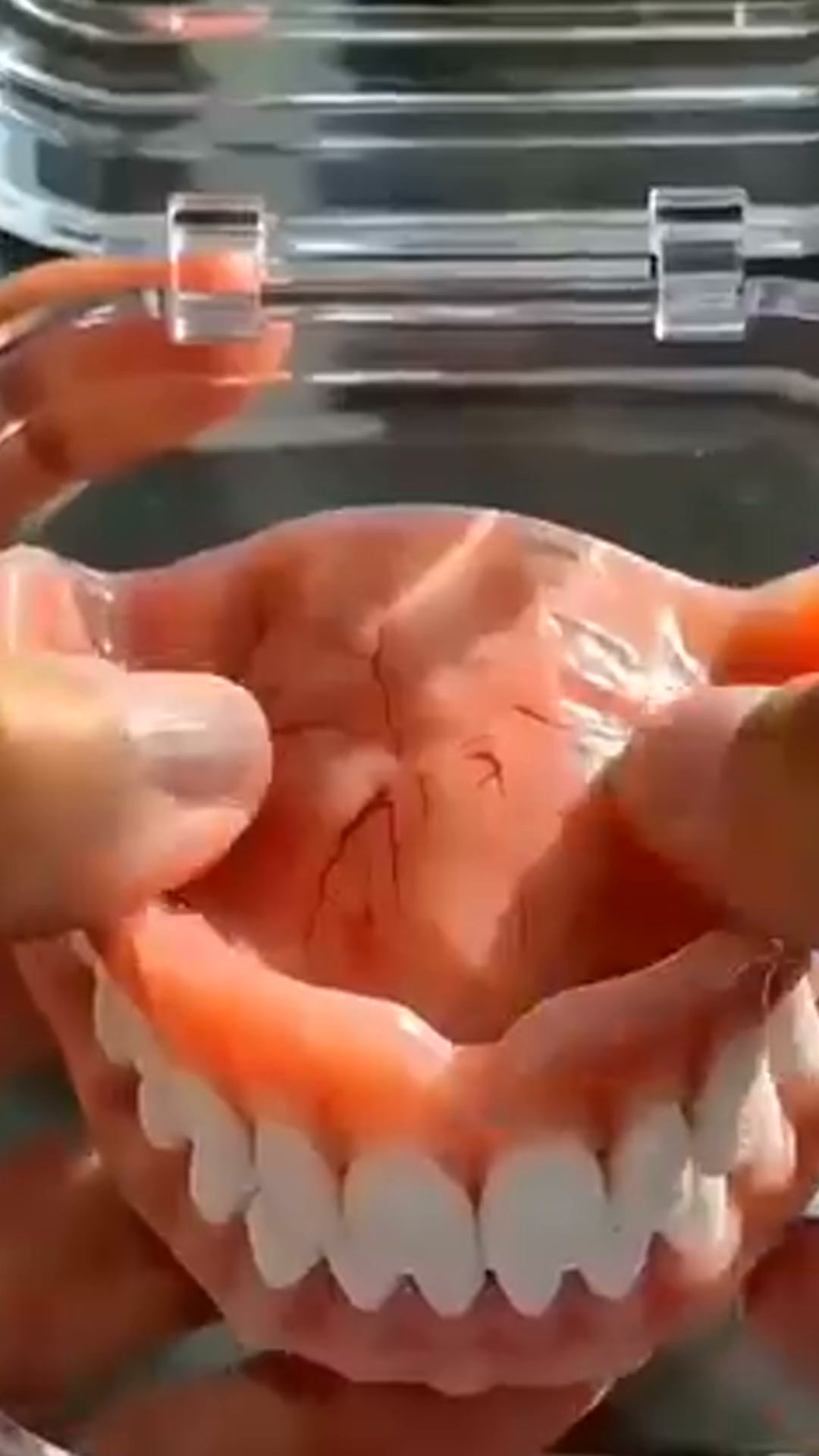 Un sourire naturel instantanément!