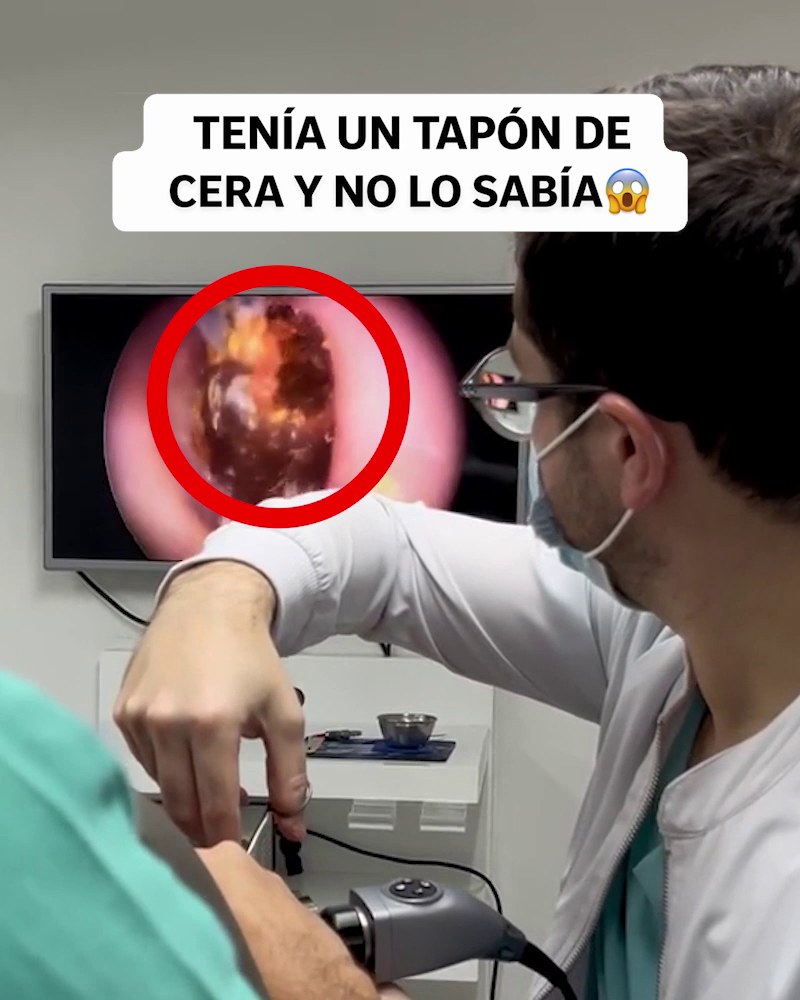 CONTRAREEMBOLSO