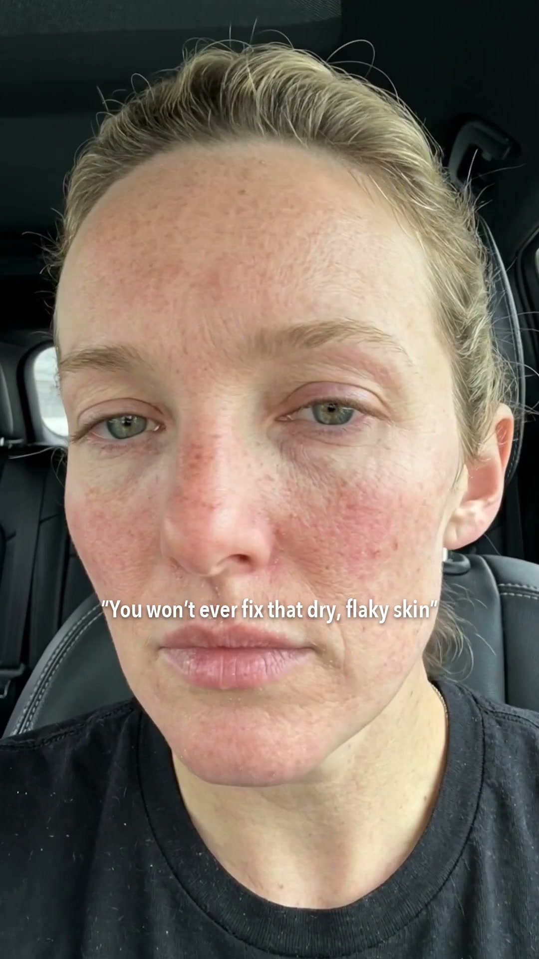 [Amazon's Pick] Hyaluronic Acid Hydrating & Plump Glow Serum