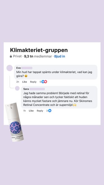 Huden tappar spänst – vad hjälper egentligen?