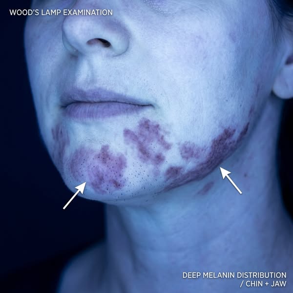 Read this if you're shaving your face daily