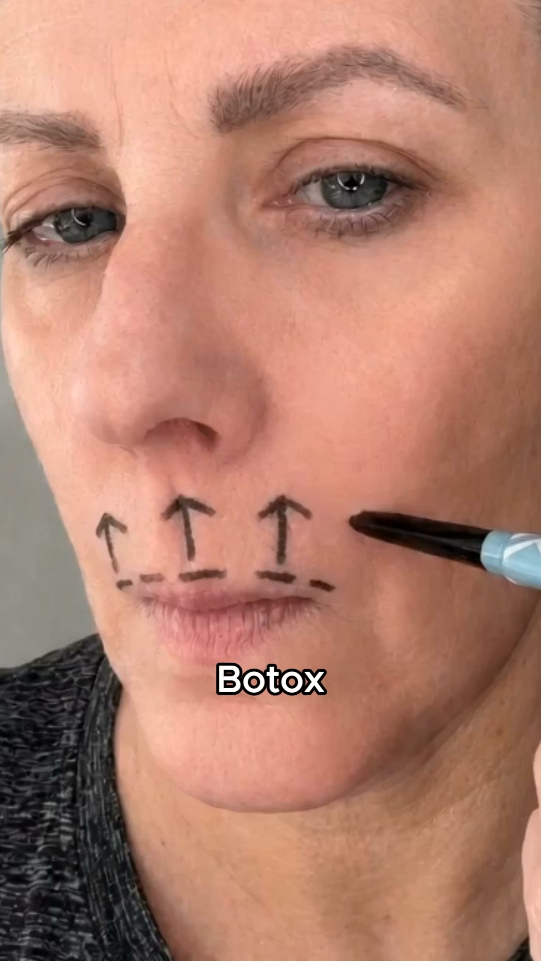 Stop using anti-aging product for lip lines