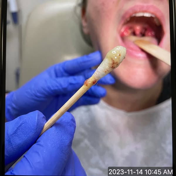 If your bad breath is constant all day, it's not coming from your mouth