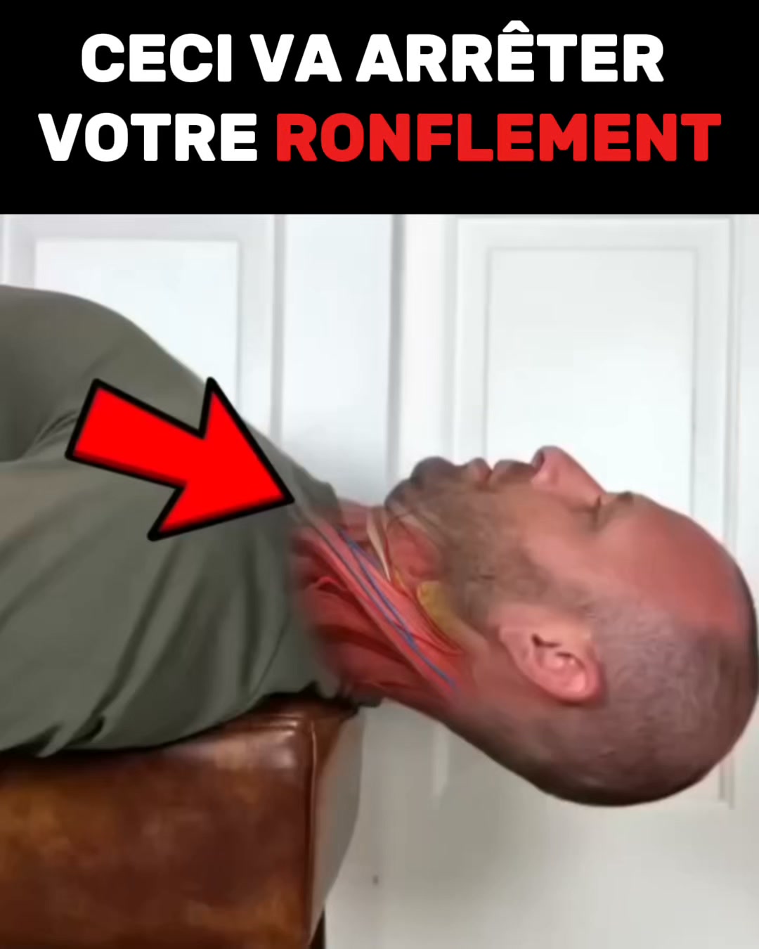 Ronflements : et si vous dormiez enfin mieux ?