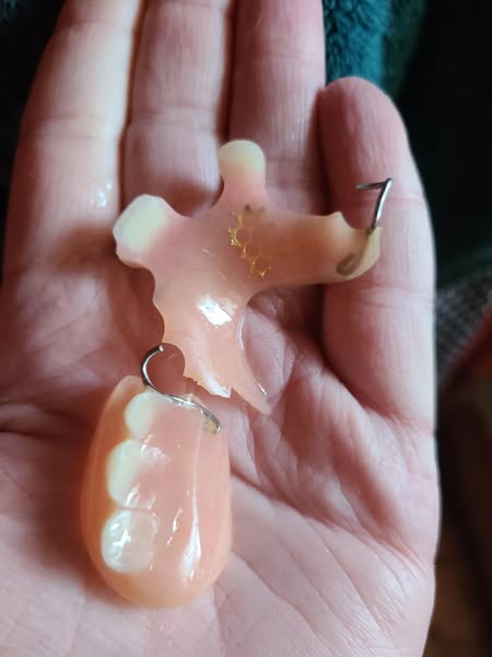 Read this if you wear dentures and use cream.