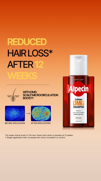 NEW: Alpecin DMG Shampoo & Serum