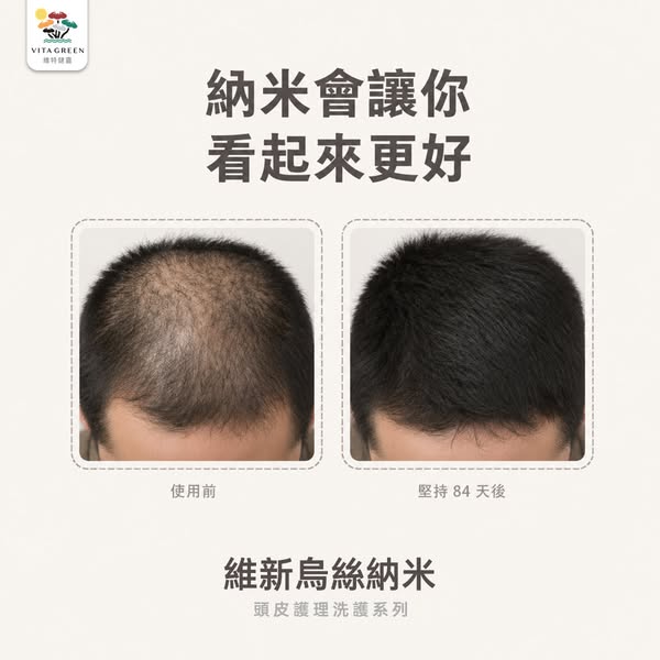 維特健靈官方海外網店｜直送全球全站免運
