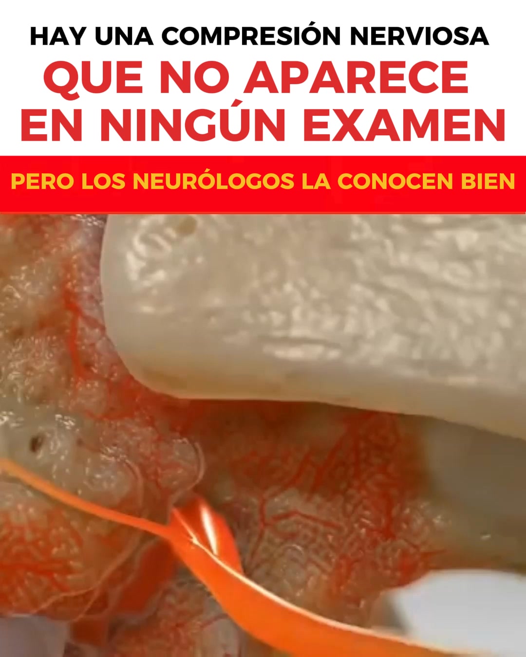 Por Qué Mareos, Taquicardia y Reflujo A Menudo Empiezan en el Cuello